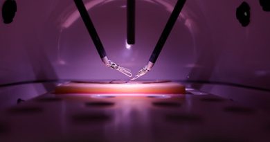 Beneficia Hospital Regional del ISSSTE en Torreón a una paciente con tumor renal mediante cirugía de robot Da Vinci